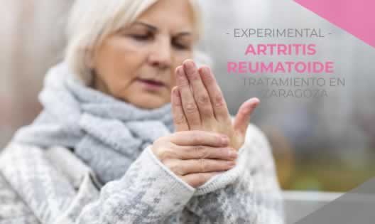 Artritis Reumatoide en Zaragoza | Peinandocanas